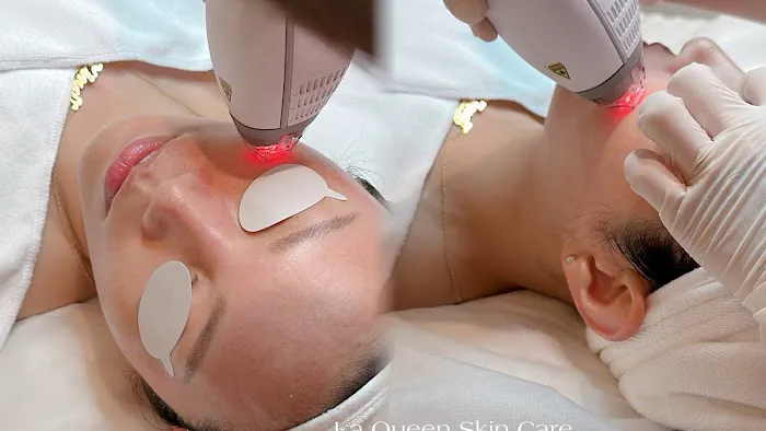 La Queen Aesthetics Skin Care Picture 2