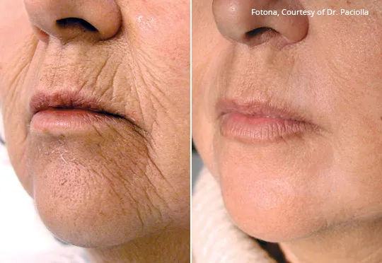 Natural Med Spa and Laser Center Picture 10