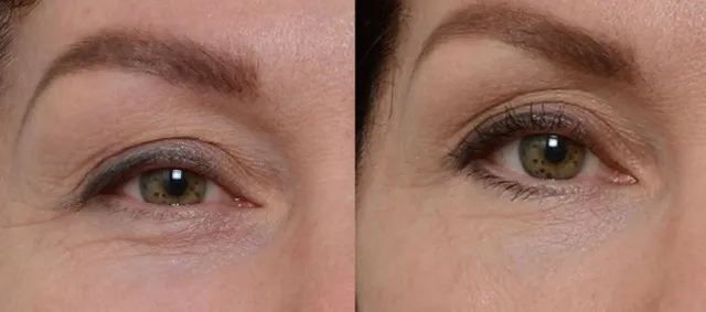 Laser Hair Removal and Aesthetics Center Picture 1