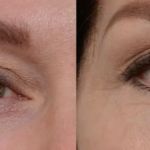 Laser Hair Removal and Aesthetics Center