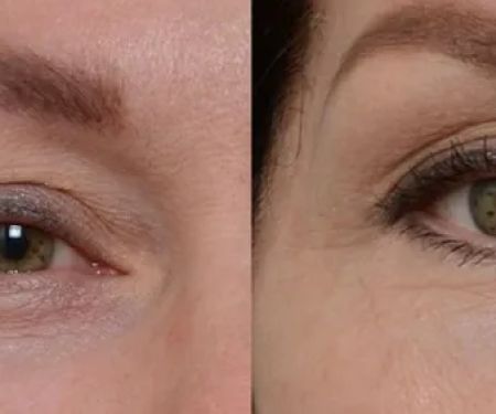 Laser Hair Removal and Aesthetics Center