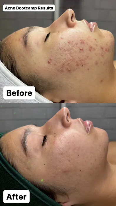 Zenith Esthetics Picture 3