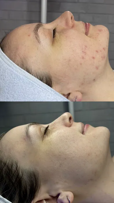 Zenith Esthetics Picture 4