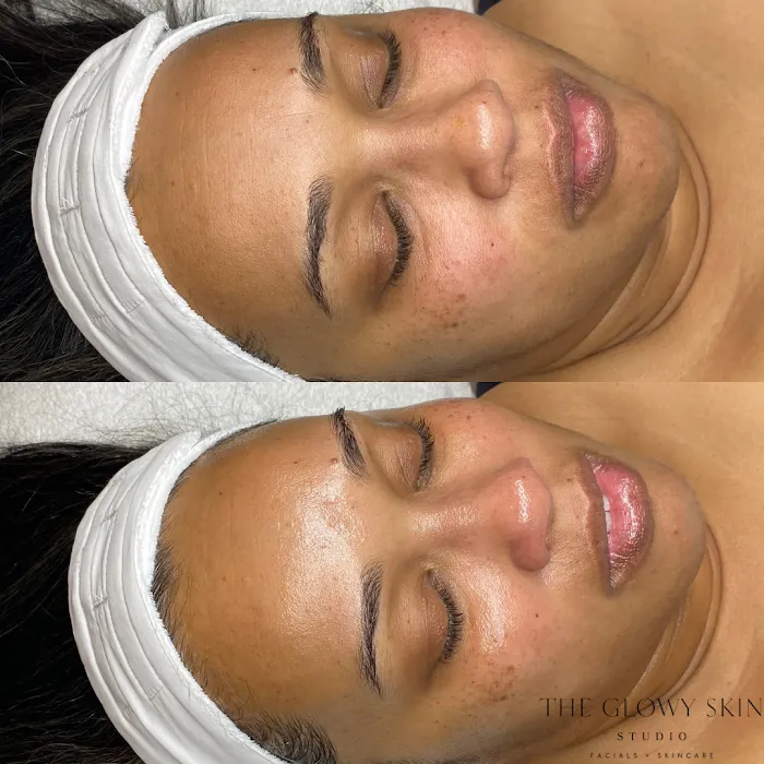 The Glowy Skin Studio Picture 6