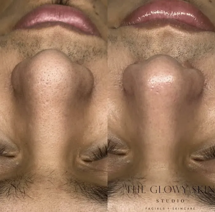 The Glowy Skin Studio Picture 10