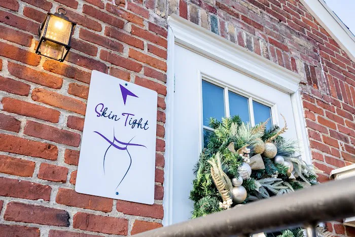 Skintight By Monica Picture 6