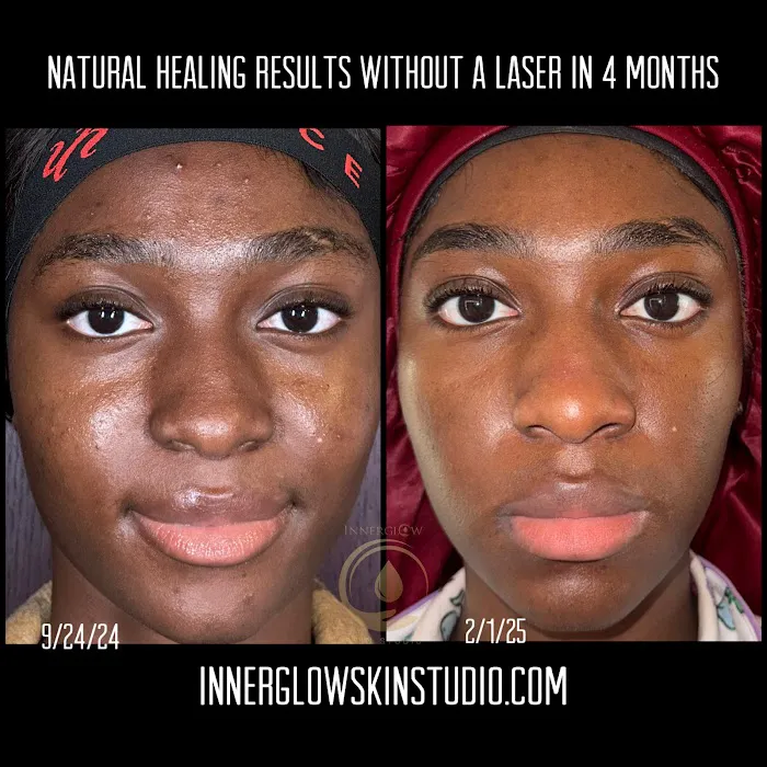 InnerGlow Skin Studio Picture 2
