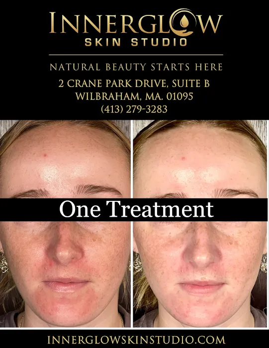 InnerGlow Skin Studio Picture 3