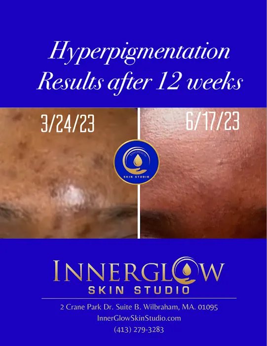 InnerGlow Skin Studio Picture 4