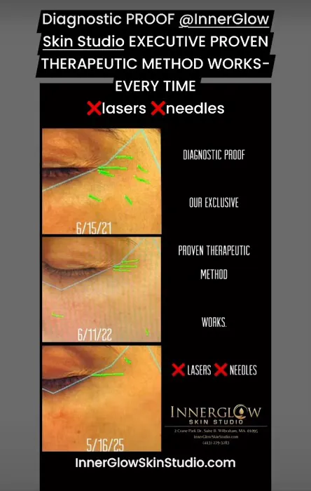 InnerGlow Skin Studio Picture 7