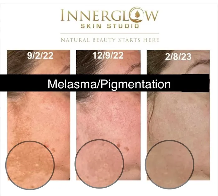InnerGlow Skin Studio Picture 9