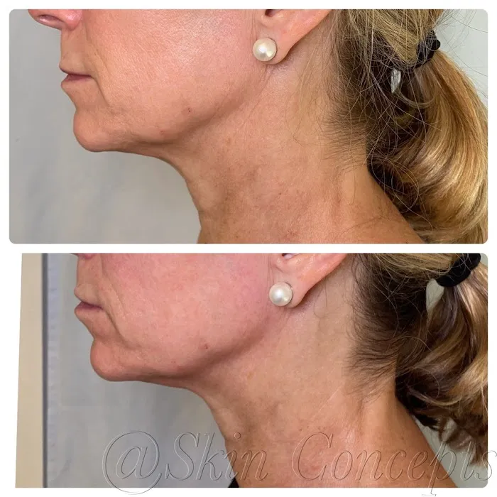 SKIN CONCEPTS Picture 4