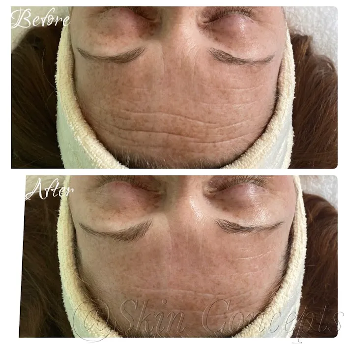 SKIN CONCEPTS Picture 6