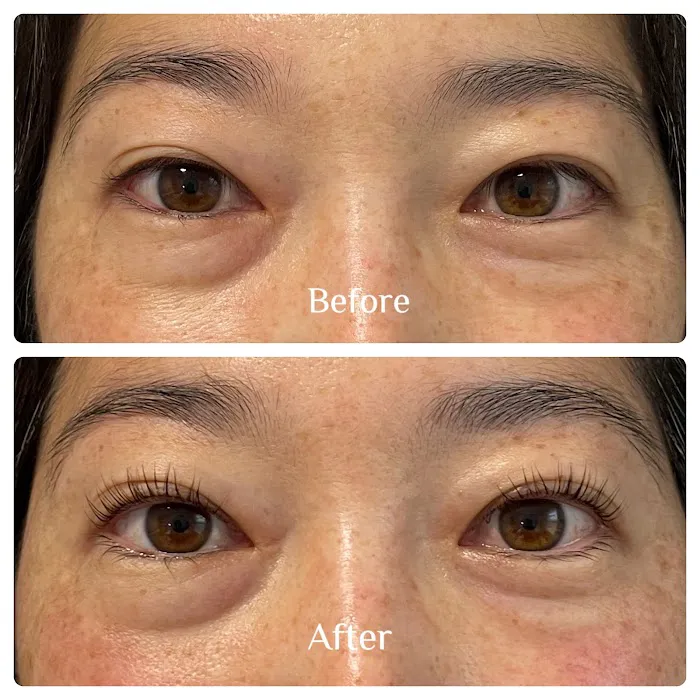 Areum Aesthetics Picture 6