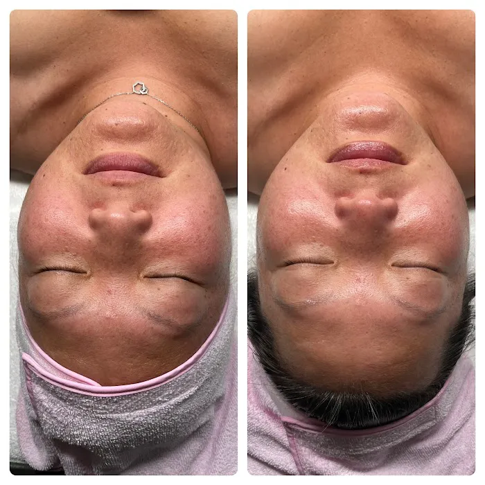 Areum Aesthetics Picture 8