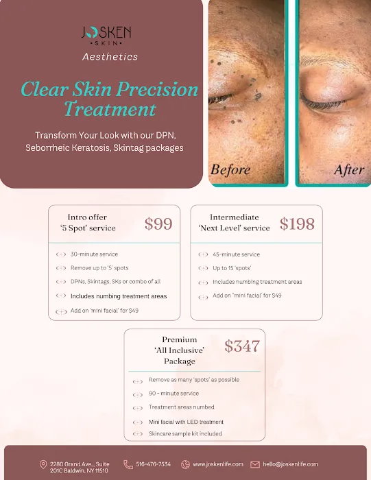 Josken Life Aesthetics Picture 5