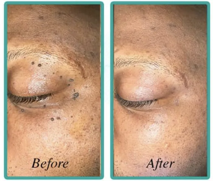 Josken Life Aesthetics Picture 6