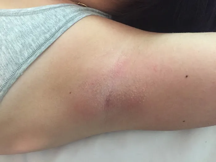 The Skin of Roses.Com Picture 8