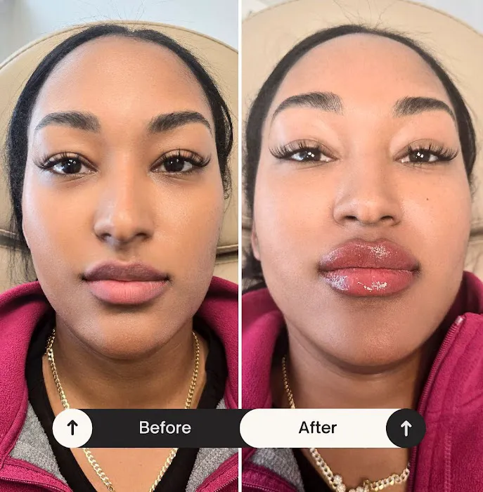 Azary Aesthetics Picture 9