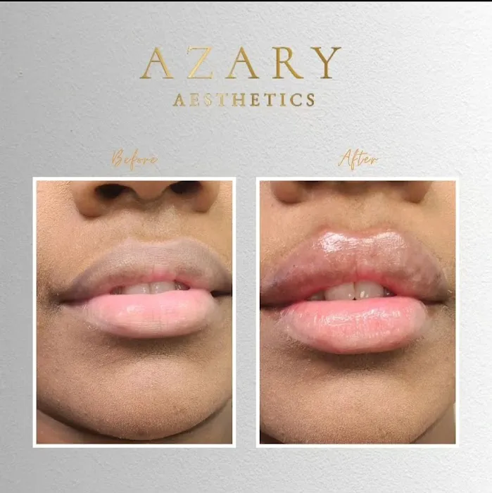 Azary Aesthetics Picture 8