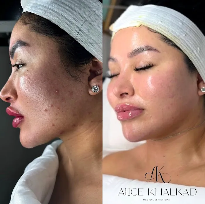 Alice Khalkad House of SKIN Picture 6