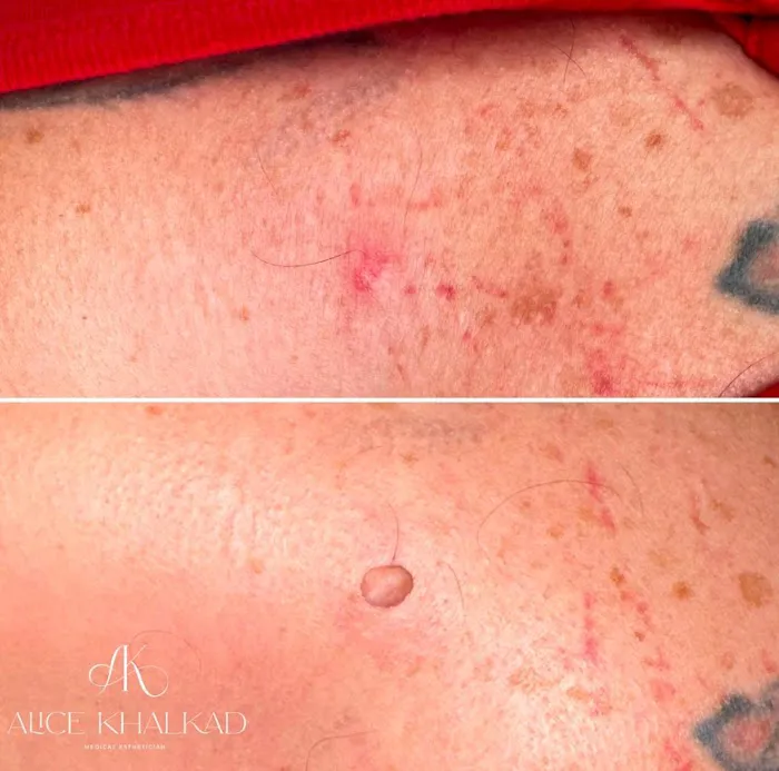 Alice Khalkad House of SKIN Picture 7