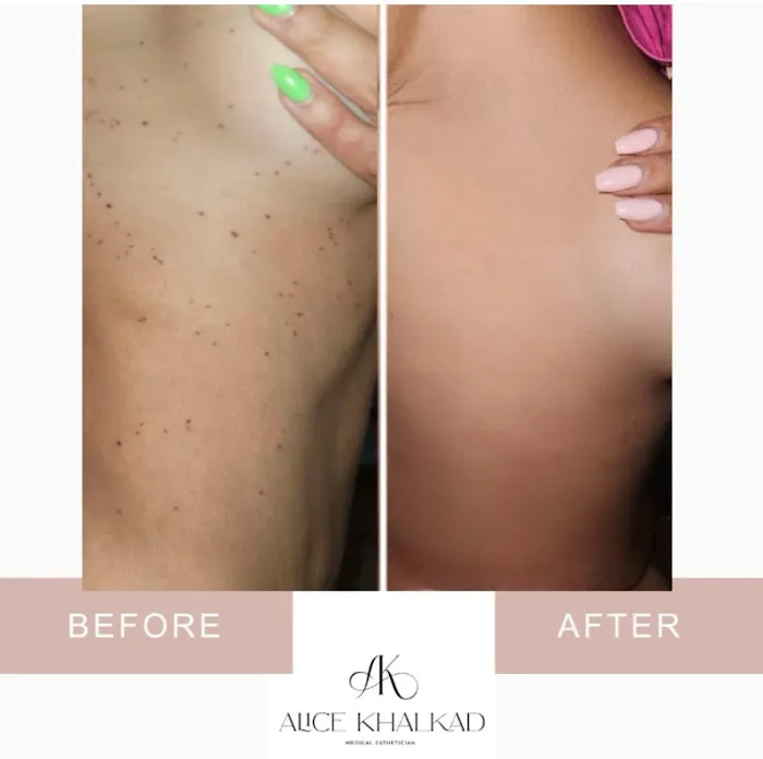 Alice Khalkad House of SKIN Picture 8