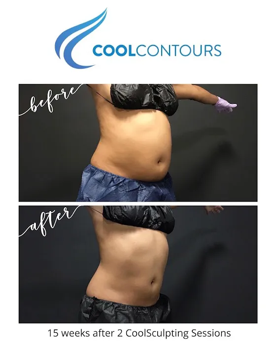 Cool Contours Picture 9