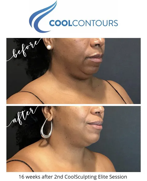 Cool Contours Picture 10