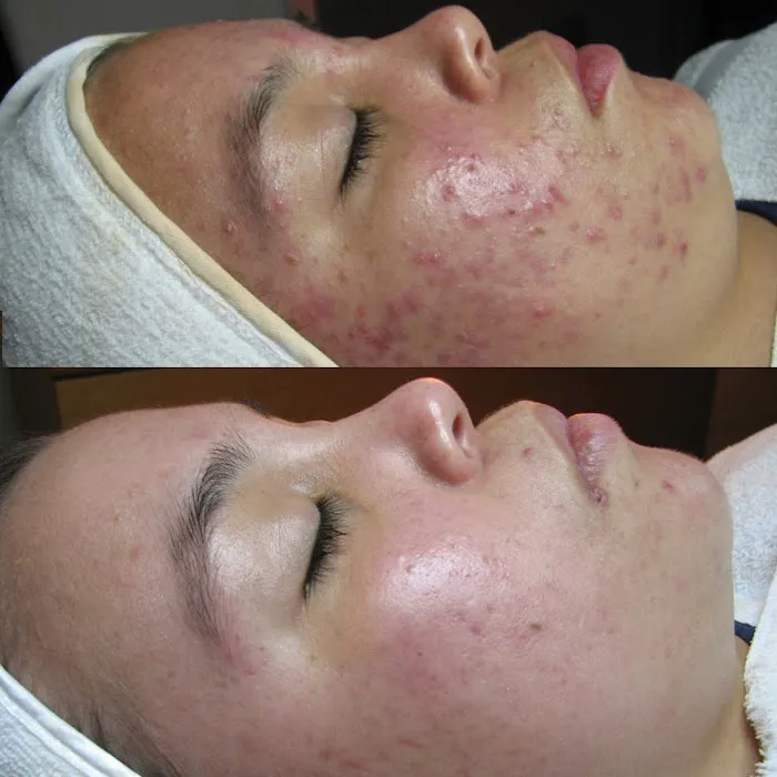 Beauty Skin Bar llc Picture 8