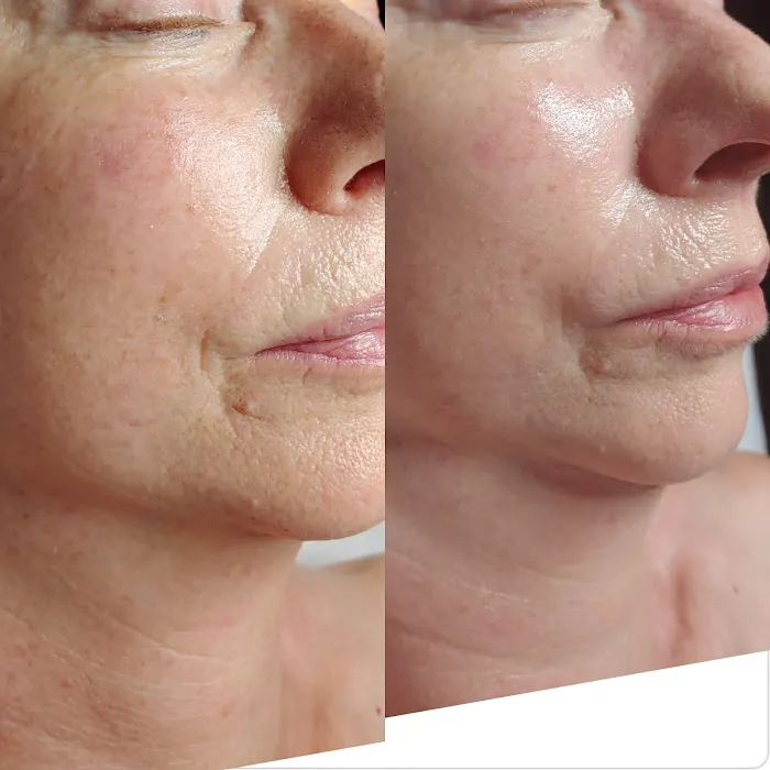 Beauty Skin Bar llc Picture 10