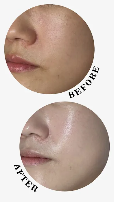 OZ Esthetic Picture 9