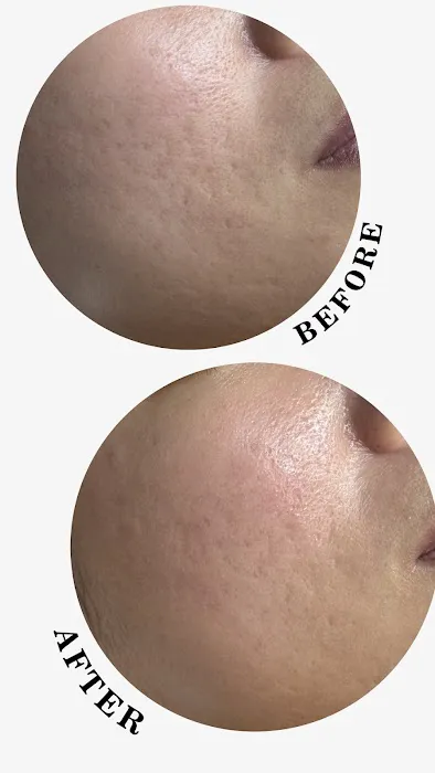 OZ Esthetic Picture 10