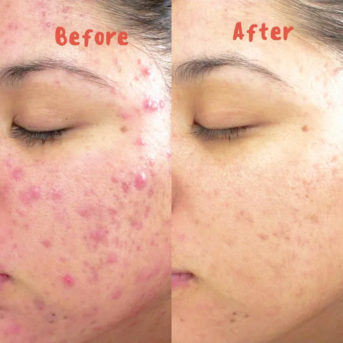 BeBloomBeauty Day Spa Picture 3