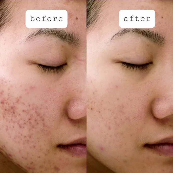 BeBloomBeauty Day Spa Picture 1