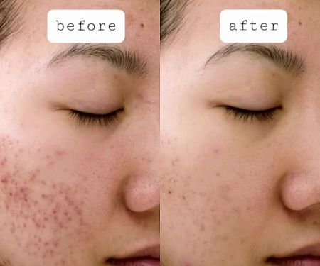 BeBloomBeauty Day Spa