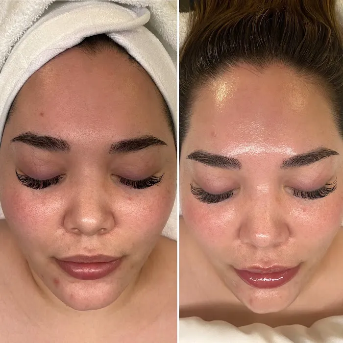 Judy Kim Aesthetics Picture 6