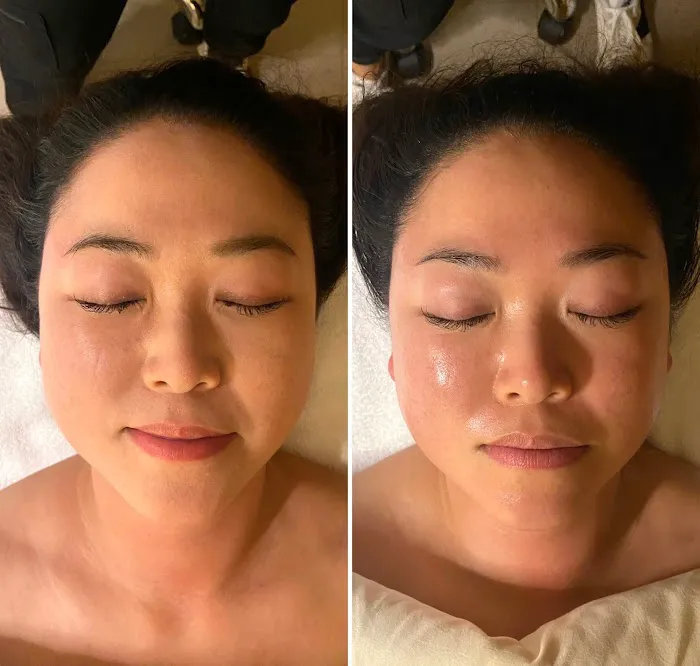 Judy Kim Aesthetics Picture 7