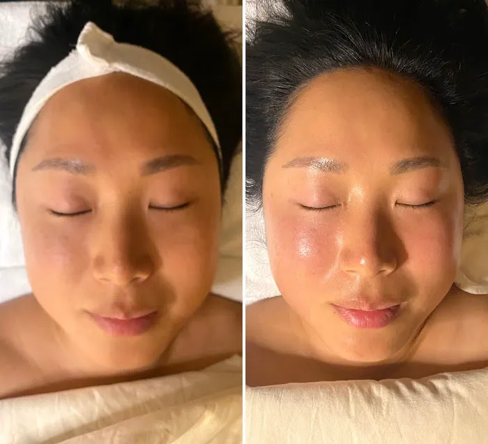 Judy Kim Aesthetics Picture 10