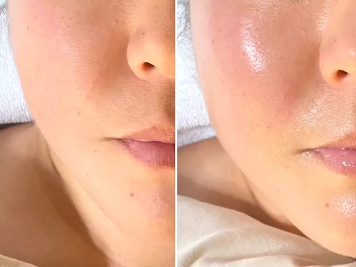 Judy Kim Aesthetics Picture 9