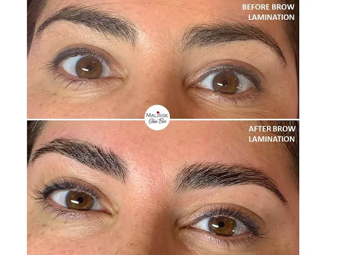 MALISSE Skin Bar Picture 9