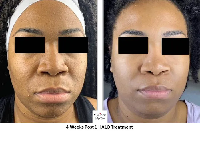 MALISSE Skin Bar Picture 10