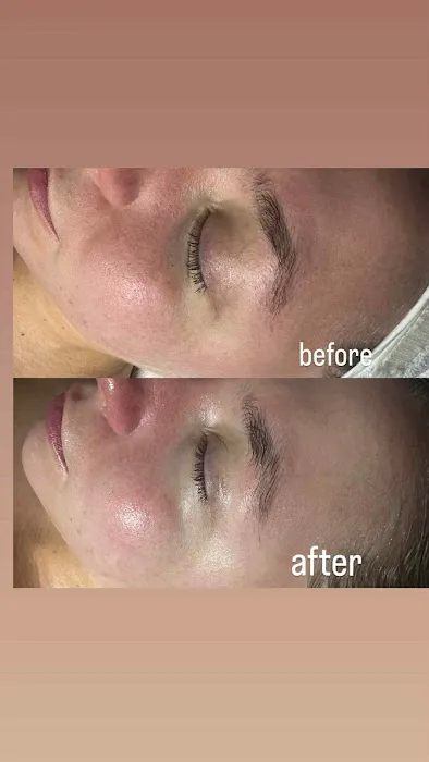 Beautify Skincare Picture 8