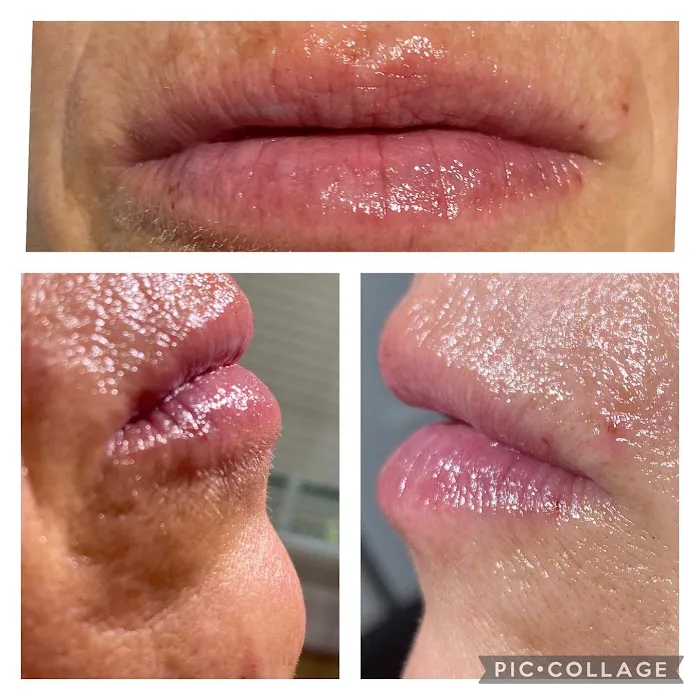 The SKN NP Picture 2