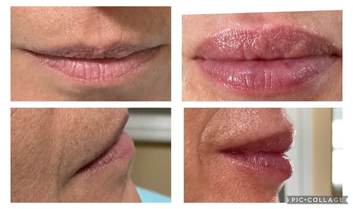 The SKN NP Picture 1