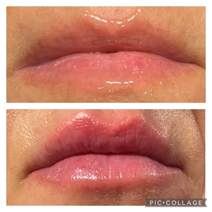 The SKN NP Picture 4