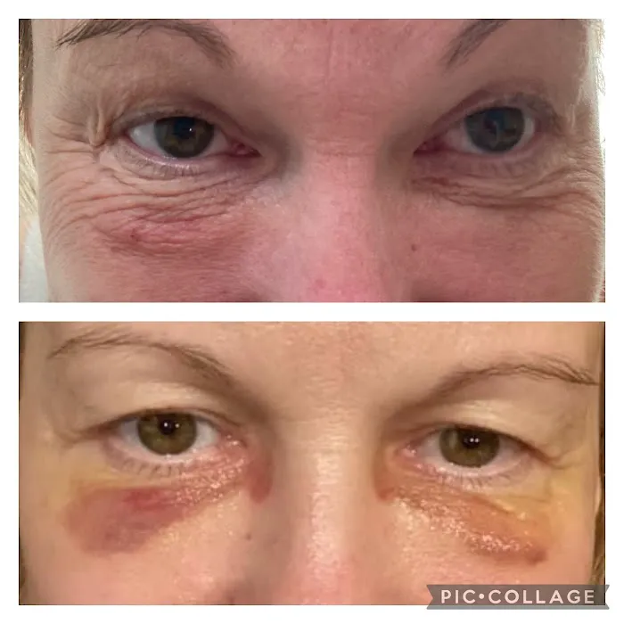 The SKN NP Picture 5