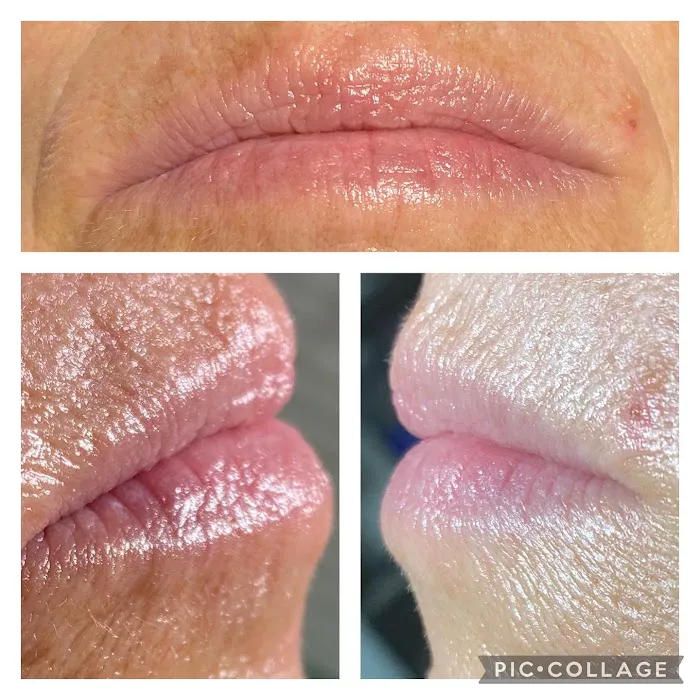 The SKN NP Picture 3