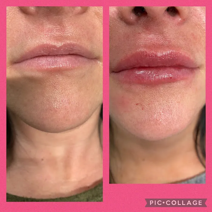 The SKN NP Picture 8