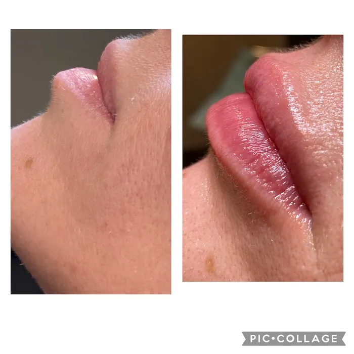 The SKN NP Picture 6